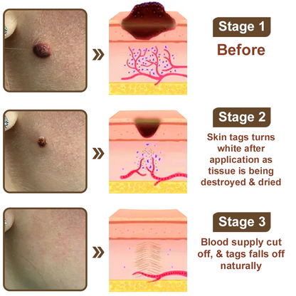 🌊🐡Zvoevo® Black Rice Skin Repair Essence Cream ⚕️ FDA Certified (Removes warts and skin growths, improves keratin buildup and seborrheic dermatitis, follicular keratosis, age spots, and bruising)