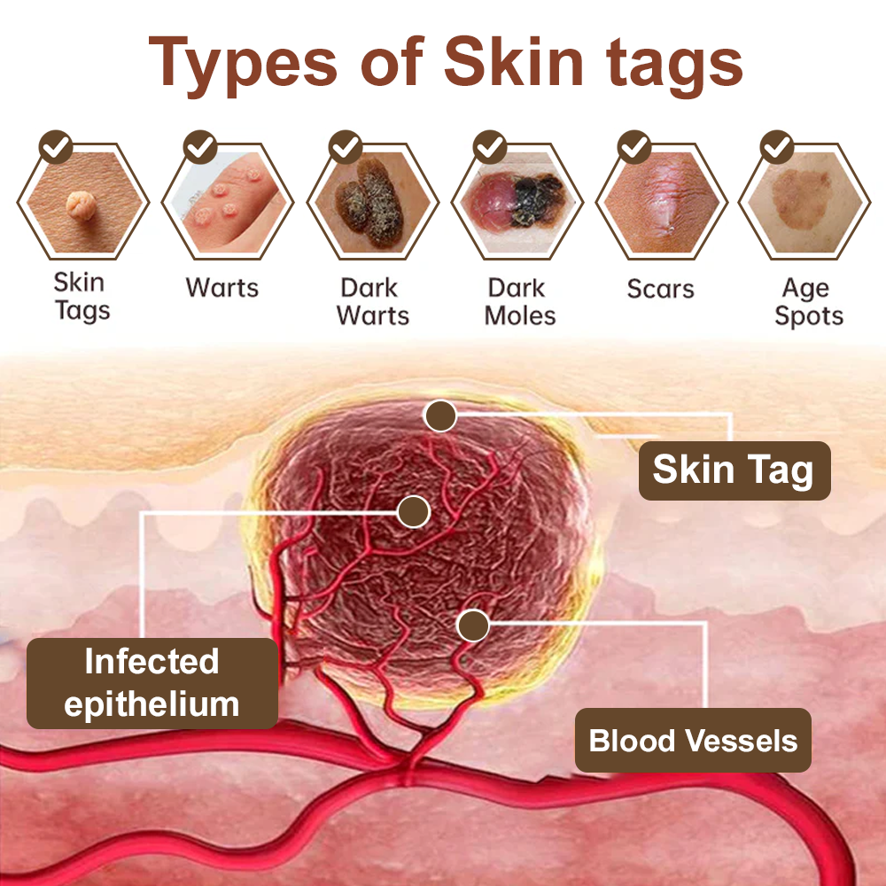 🌊🐡Zvoevo® Black Rice Skin Repair Essence Cream ⚕️ FDA Certified (Removes warts and skin growths, improves keratin buildup and seborrheic dermatitis, follicular keratosis, age spots, and bruising)