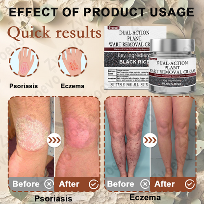 🌊🐡Zvoevo® Black Rice Skin Repair Essence Cream ⚕️ FDA Certified (Removes warts and skin growths, improves keratin buildup and seborrheic dermatitis, follicular keratosis, age spots, and bruising)